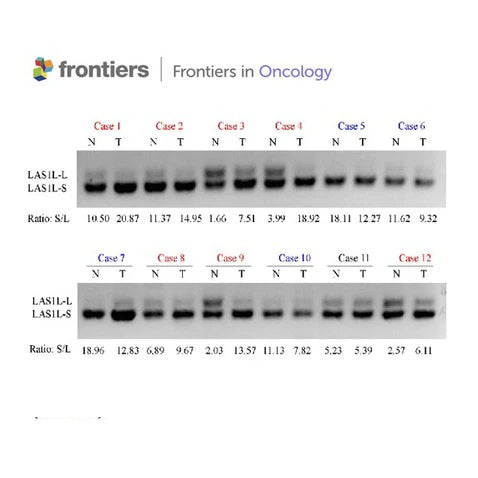 Cited from" Knockdown of hnRNPA1 Promotes NSCLC Metastasis and EMT by Regulating Alternative Splicing of LAS1L exon 9, Front. Oncol., 23 June 2022. Molecular and Cellular Oncology, Volume 12 - 2022 "