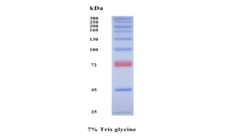 Figure 1 7% SDS-PAGE electrophoresis results