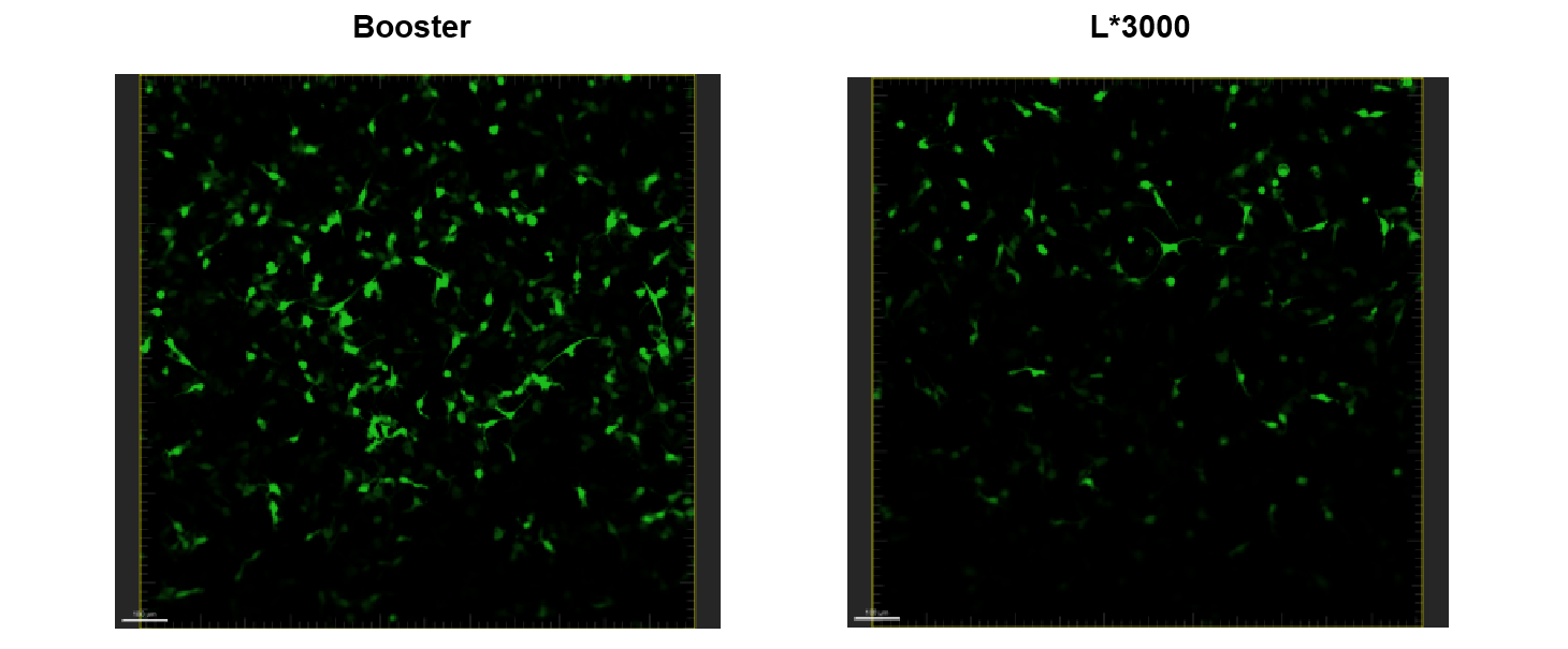 Figure 4. Plasmid EGFR DNA transfection in primary dermal fibroblasts using Booster DNA&RNA Transfection Reagent versus L*3000.